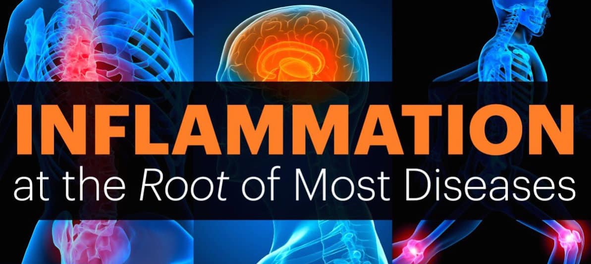 Personal training in Bellevue